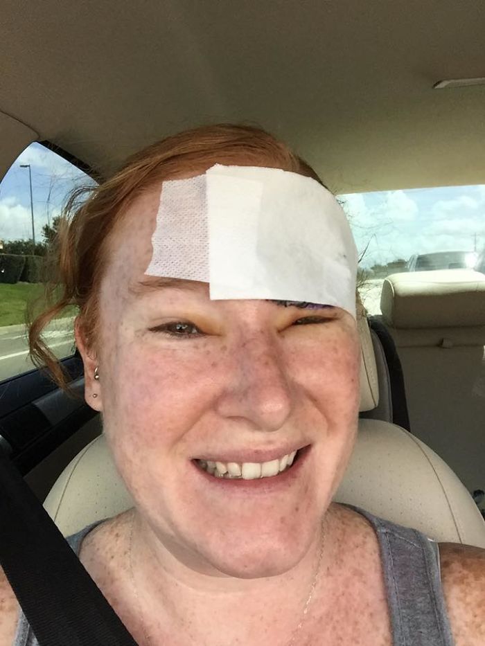 skin-cancer-melanoma-photo-diary-bethany-greenway-5-5993eb0ecc388__700.jpg