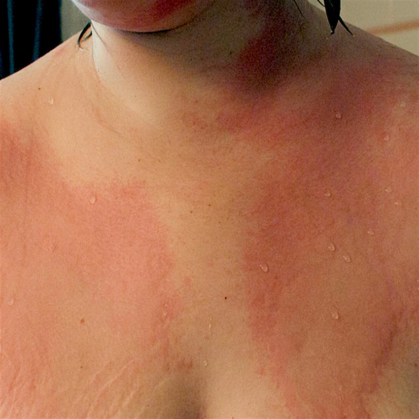 sore-nipples-four.jpg
