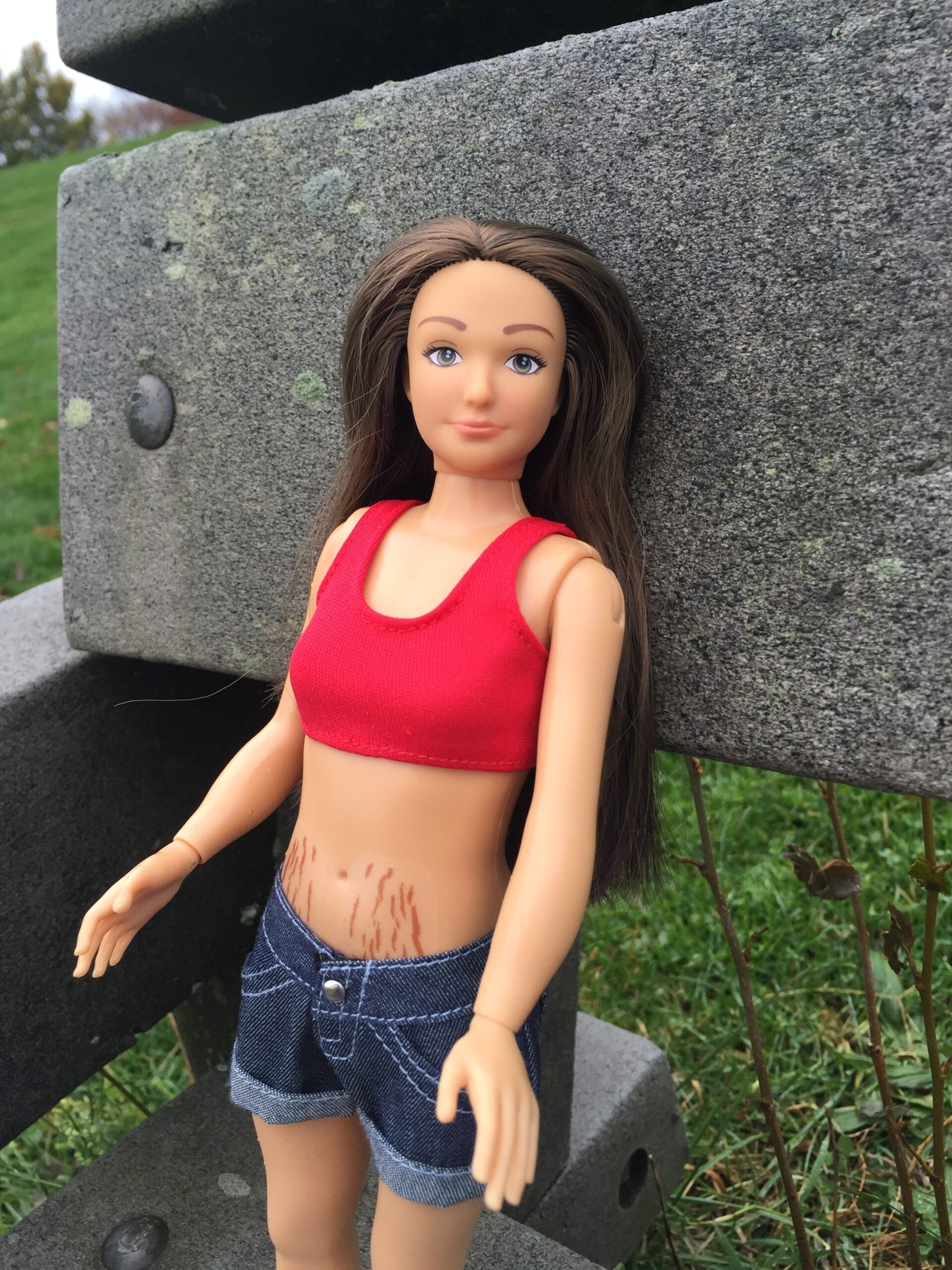 stretch-marks1-e1416379879604.jpg