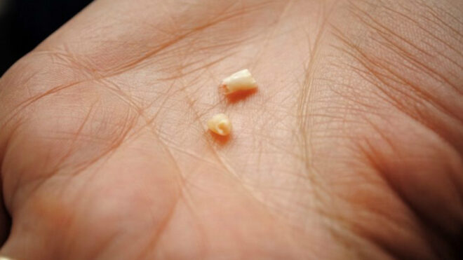 teeth
