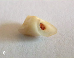 tooth1-2.jpg