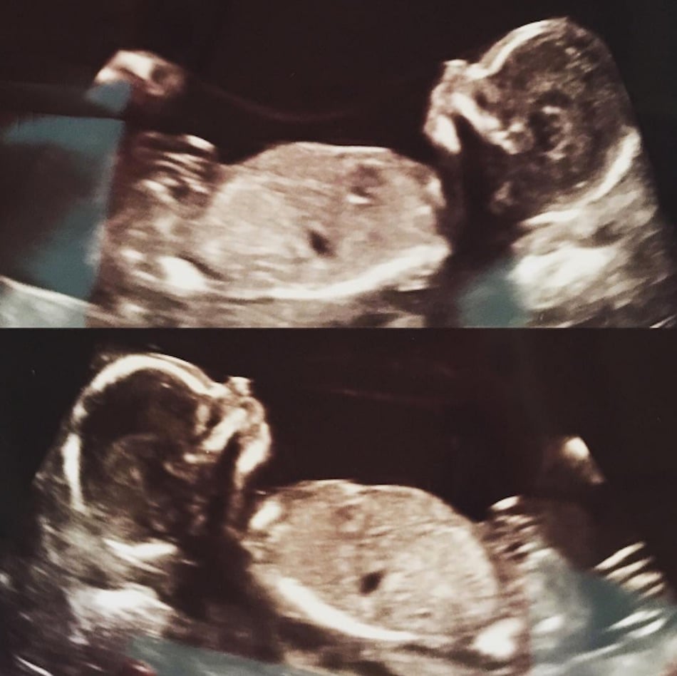 twins-4.jpg twins-4.jpg