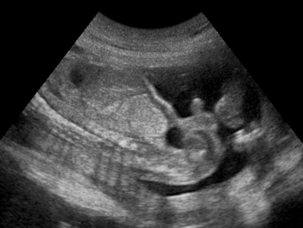 ultrasound-1.jpg