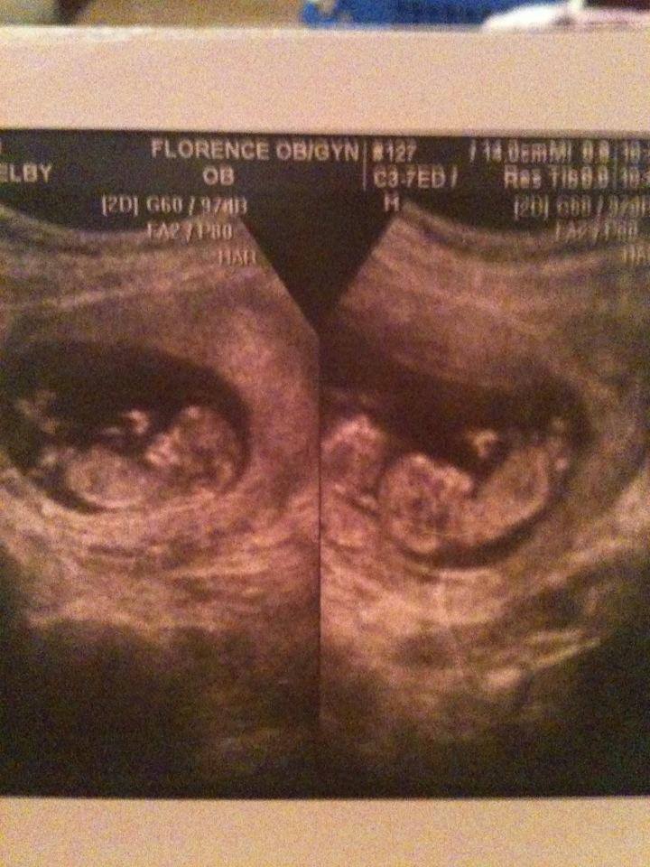 walker-willis-ultrasound.jpg walker-willis-ultrasound.jpg
