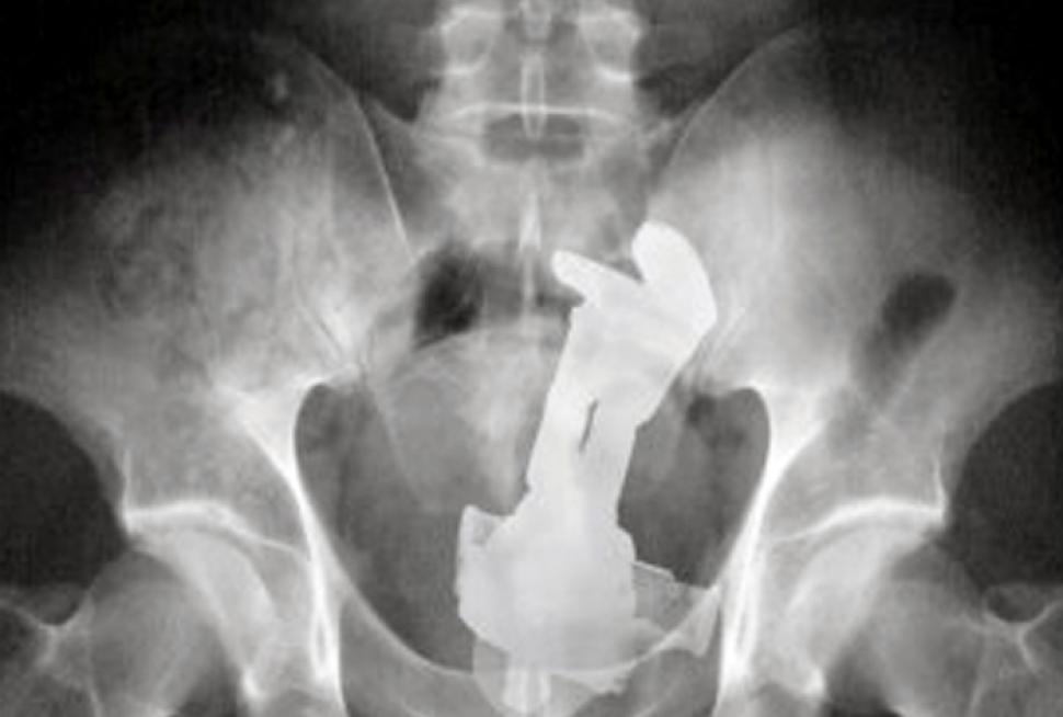 xray19n-1-web-1.jpg