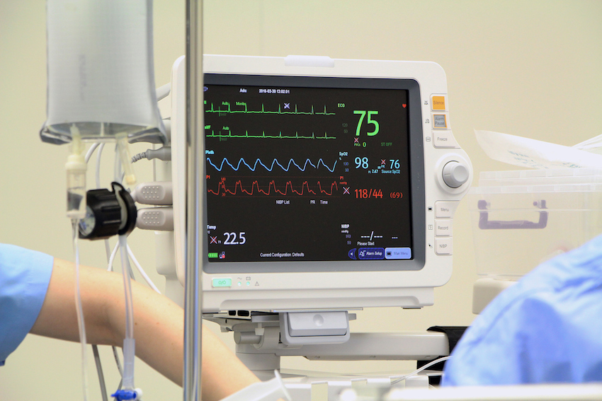 ecg monitoring