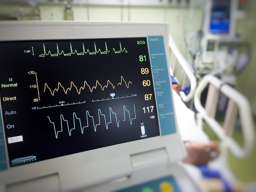 EKG monitor