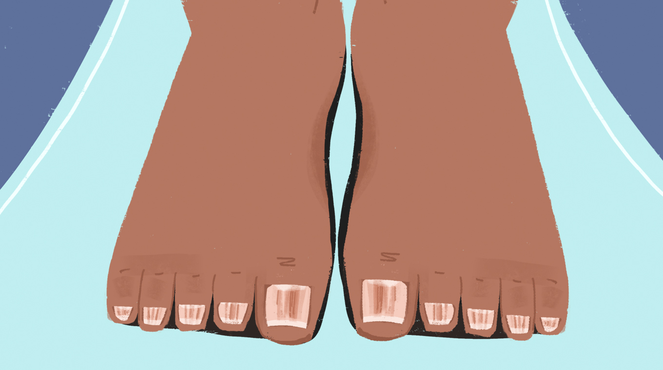 IMAGE_7_Red_Lines_Under_Toenail.jpg