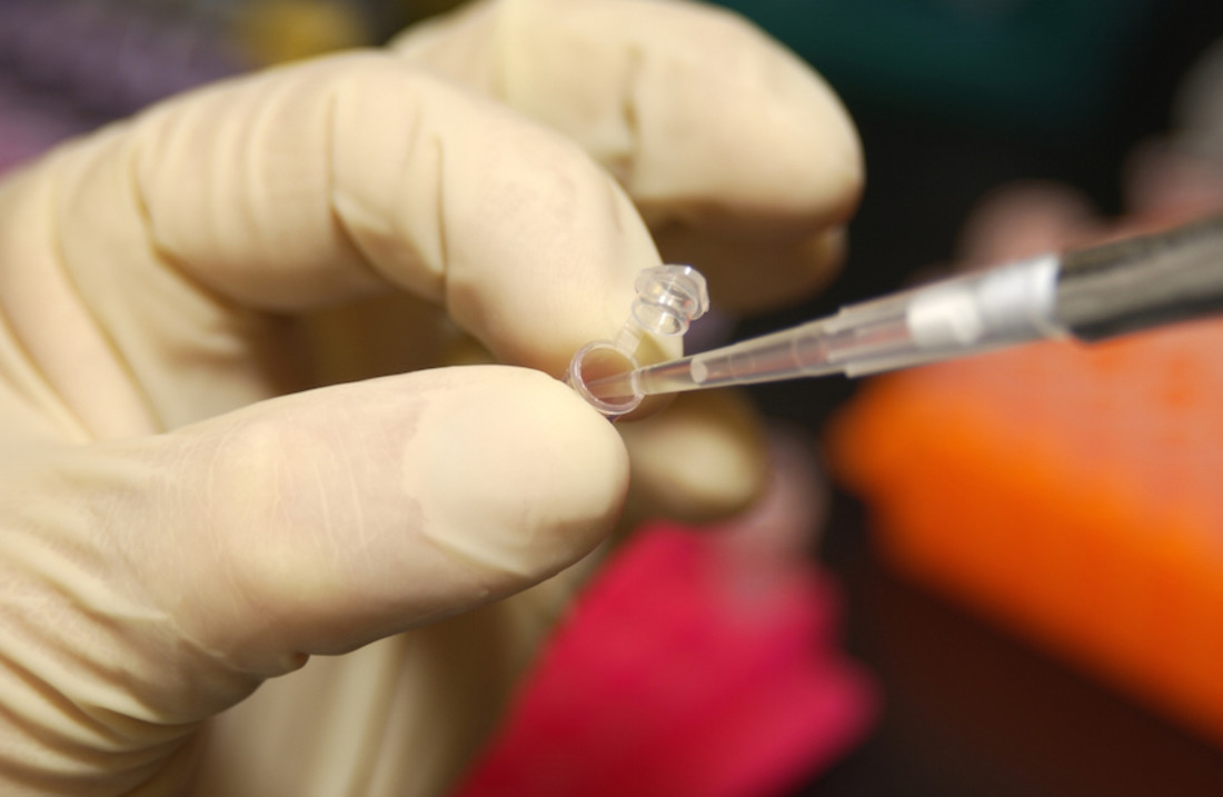NHGRI_researcher_uses_a_pipette_to_remove_DNA_from_a_micro_test_tube-1.jpg
