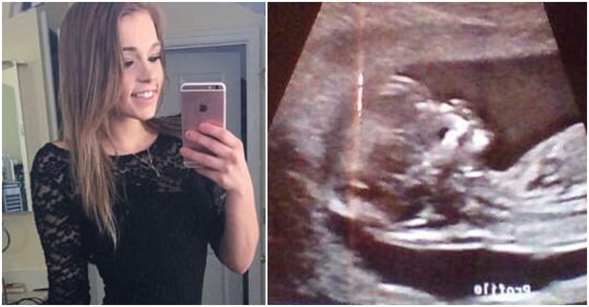 Strangers Accuse Teen Of Faking When She Shows Off Completely Flat Stomach At 6 Months Pregnant