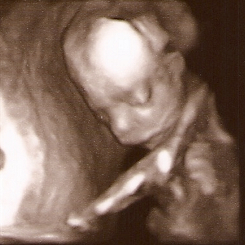 baby-in-the-womb-10.jpg