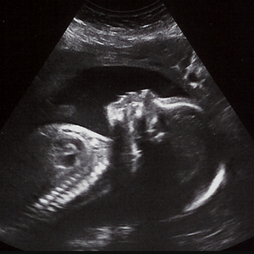 baby-in-the-womb-eight.jpg