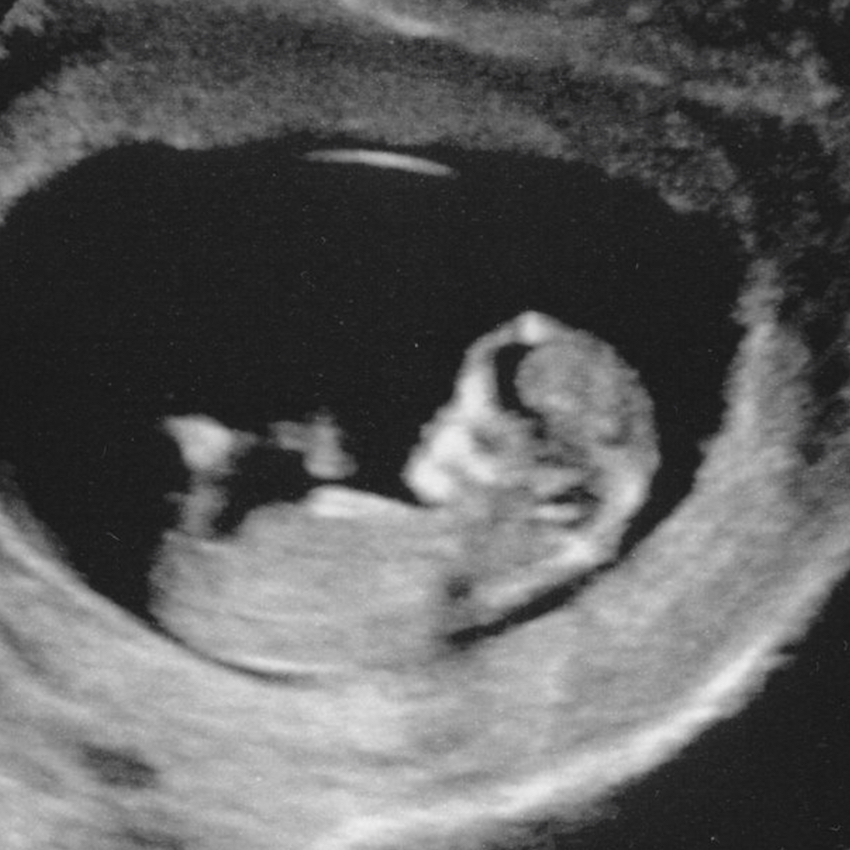 baby-in-the-womb-five.jpg