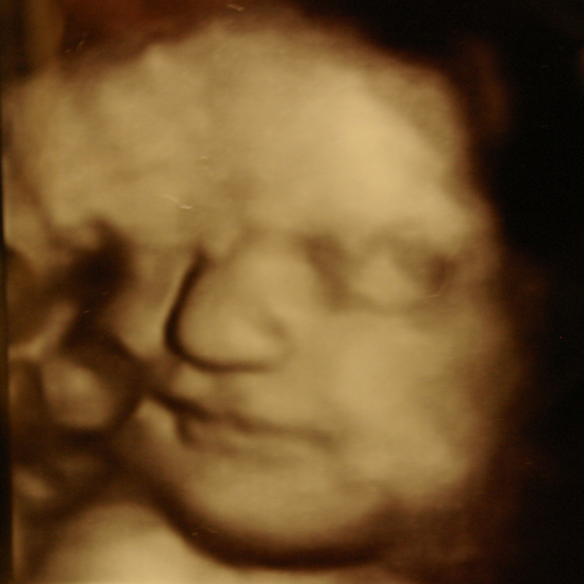 baby-in-the-womb-nine.jpg