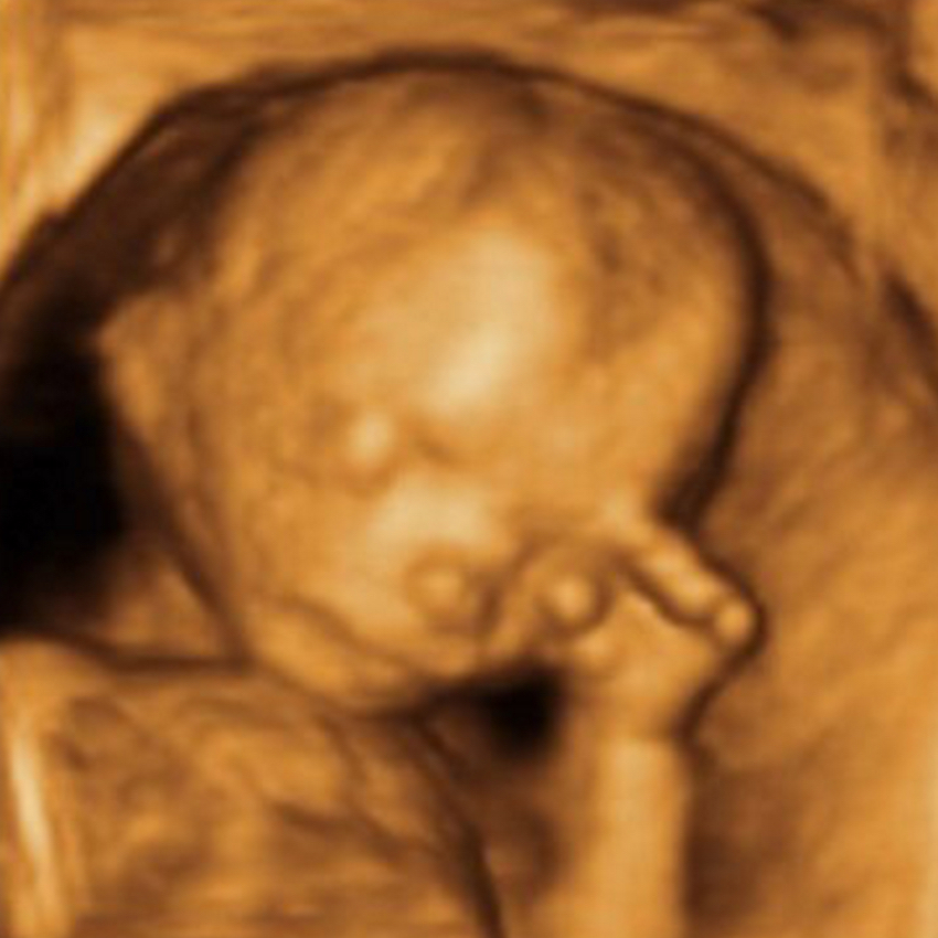 baby-in-the-womb-six.jpg