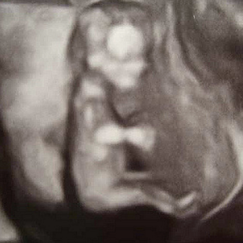 baby-in-the-womb-three.jpg