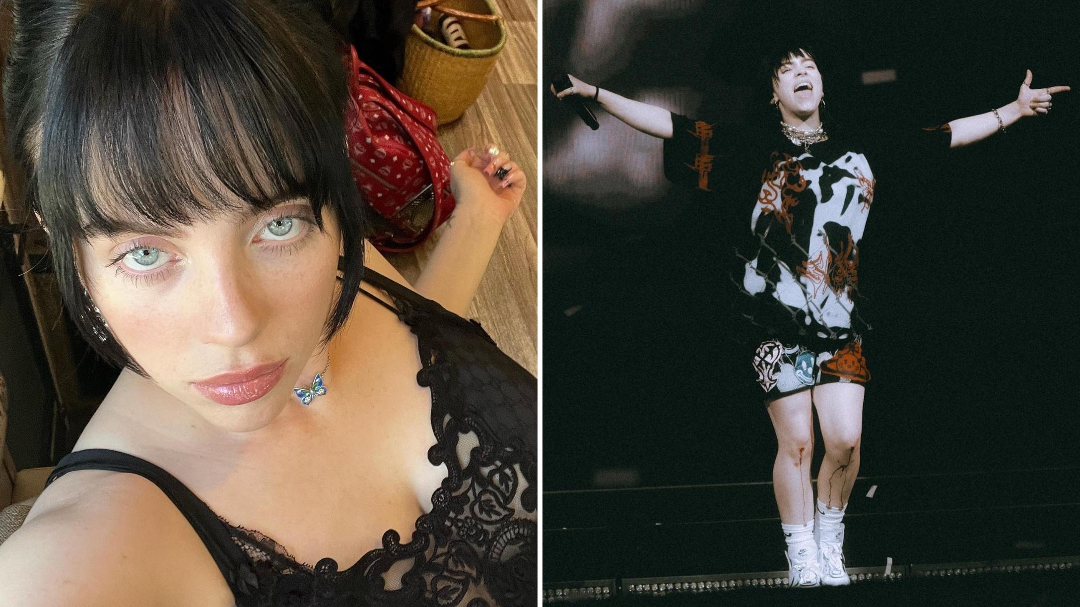 Billie Eilish Shares What It's Like To Be Laughed At Over Tics Due To