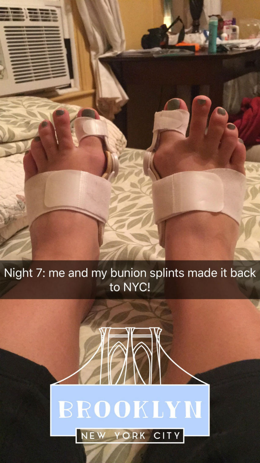 bunion-final.jpg