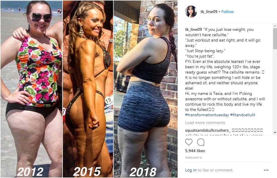 cellulite-instagram5.jpg