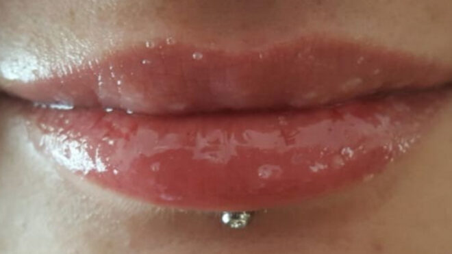 Chapped Lips 1280