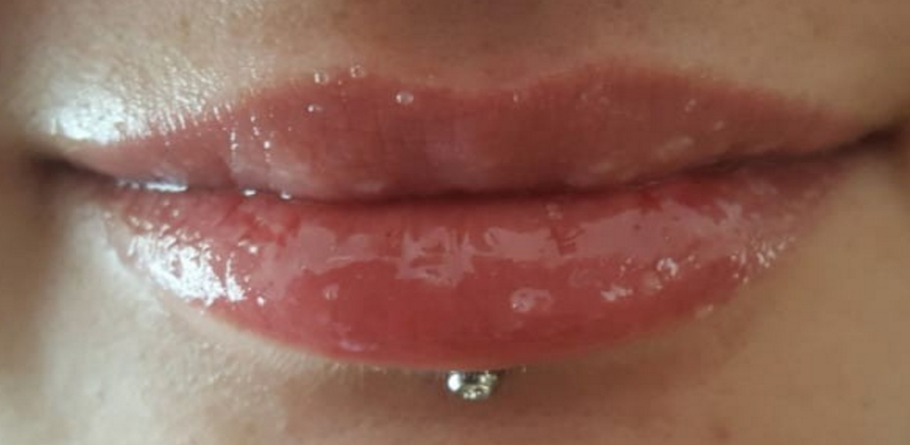 Chapped Lips 1280