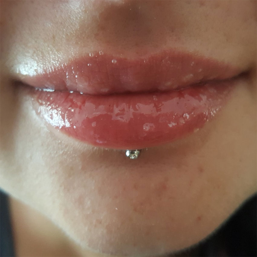 chapped-lips-8.jpg