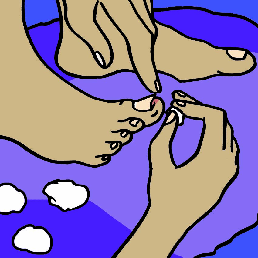 embeddedIMG_HowToGetRidOfIngrownToenails_850px_3.jpg