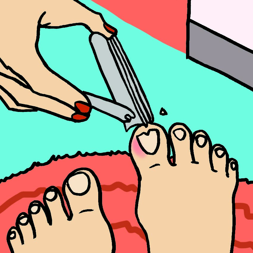 embeddedIMG_HowToGetRidOfIngrownToenails_850px_5.jpg