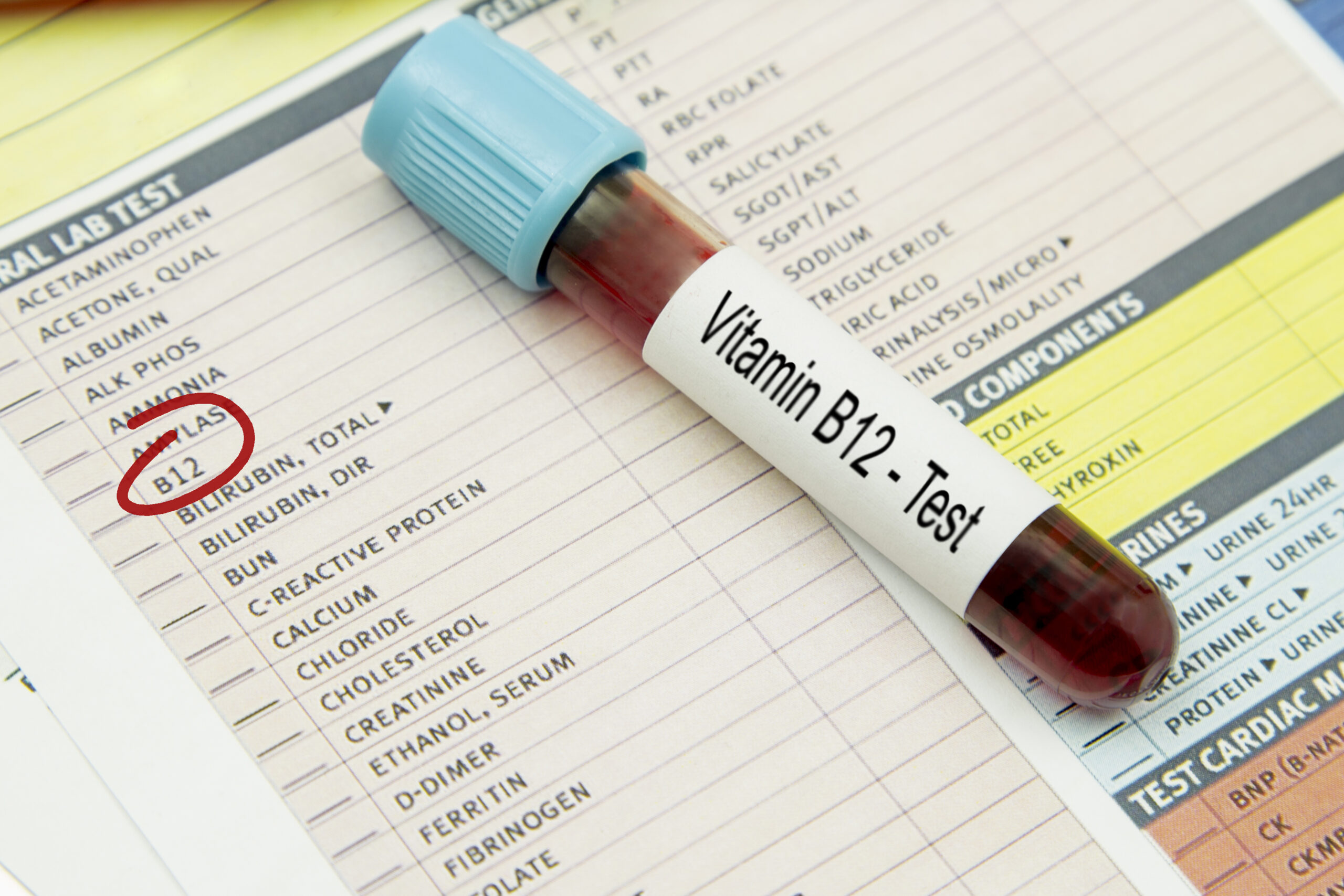 vitamin B12 test