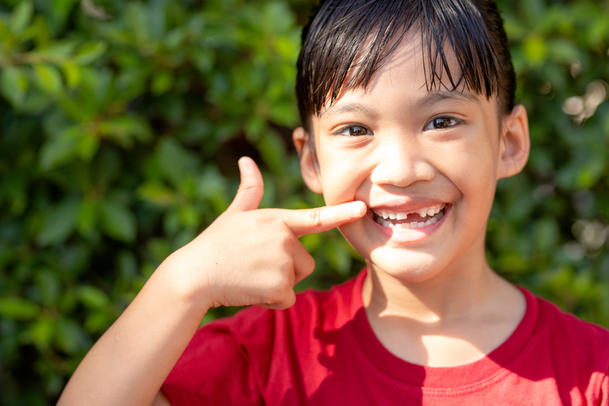 little girl showing her broken milk teeth