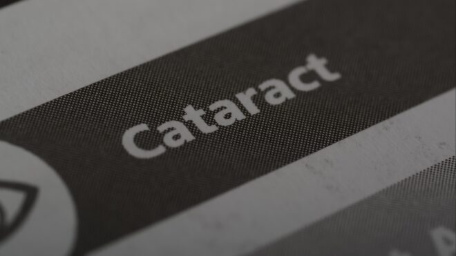 Cataract