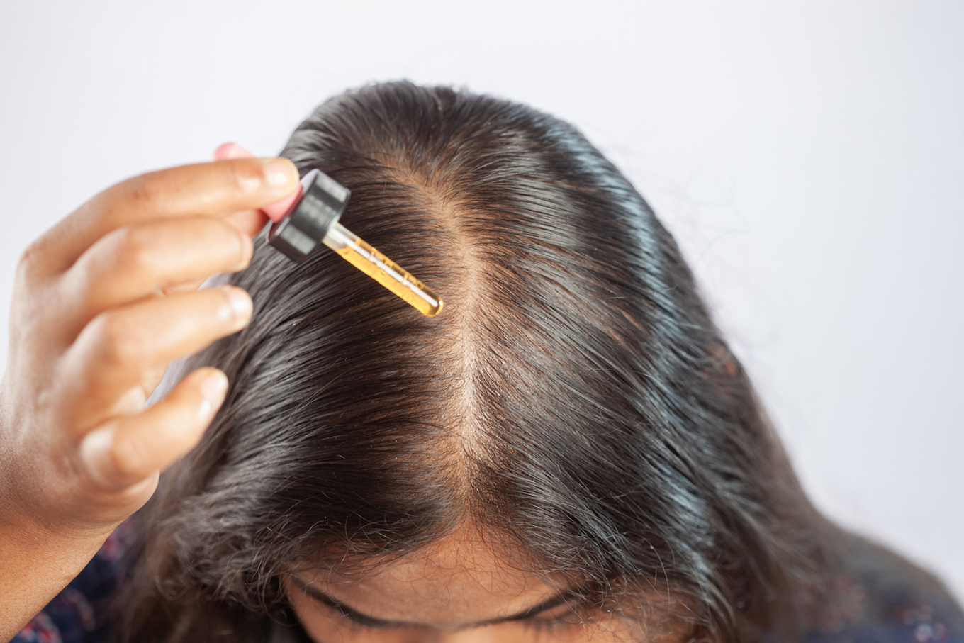 female using hair serum or minoxidil or hair oil for the treatment of hair fall or female pattern baldness