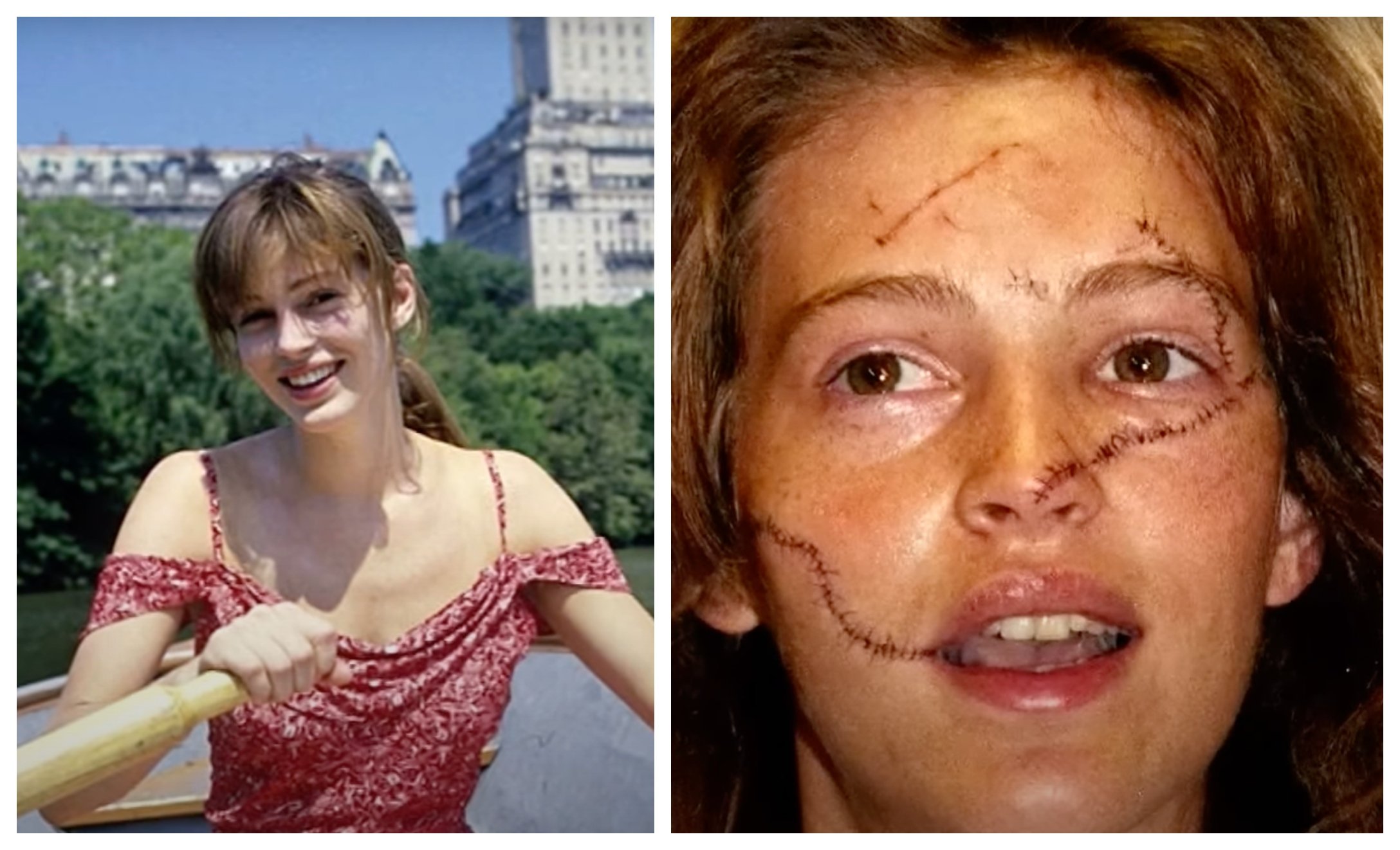 Former Model Who Was Attacked Wants To Help Others Through Trauma