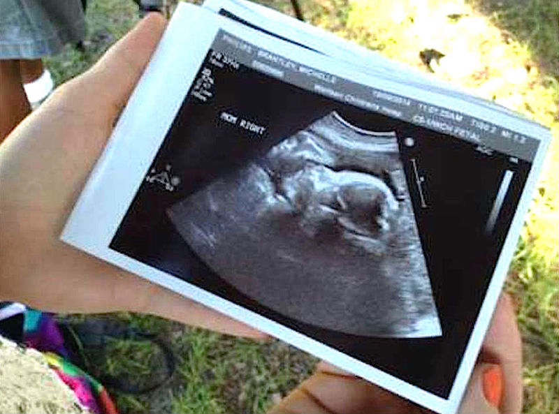 sonogram1-copy1.jpg