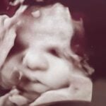 amanda foster ultrasound