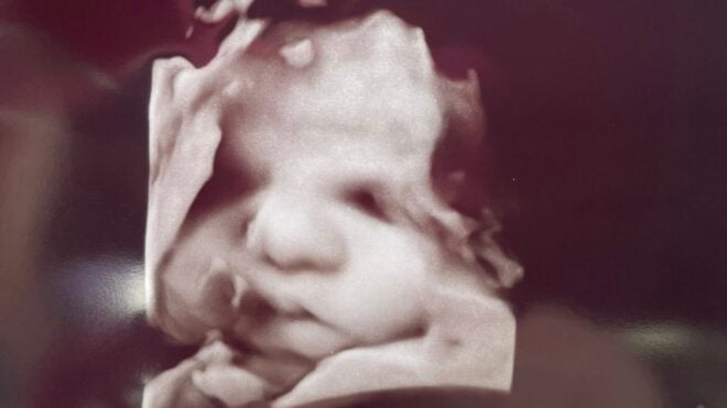 amanda foster ultrasound