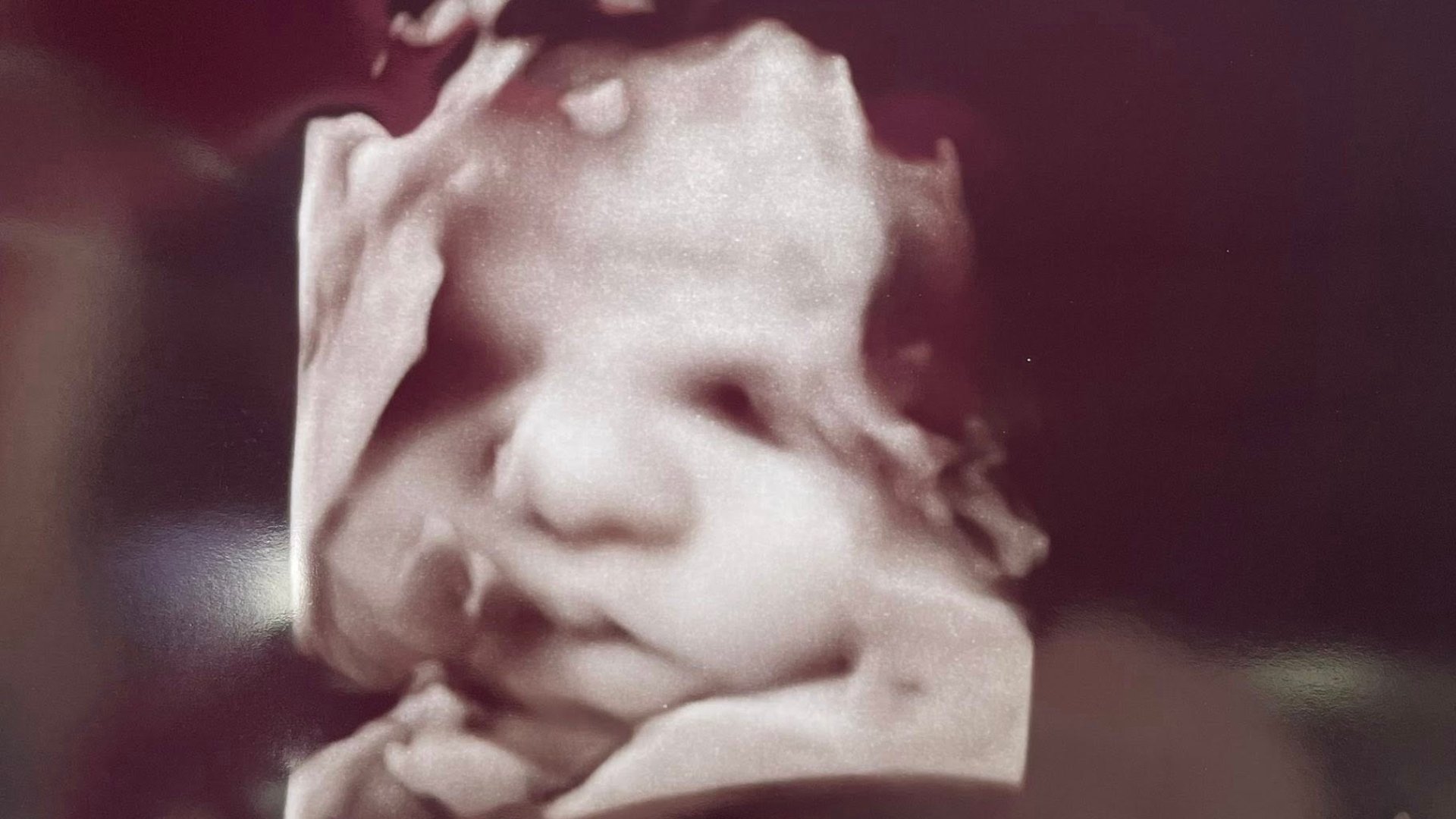 amanda foster ultrasound