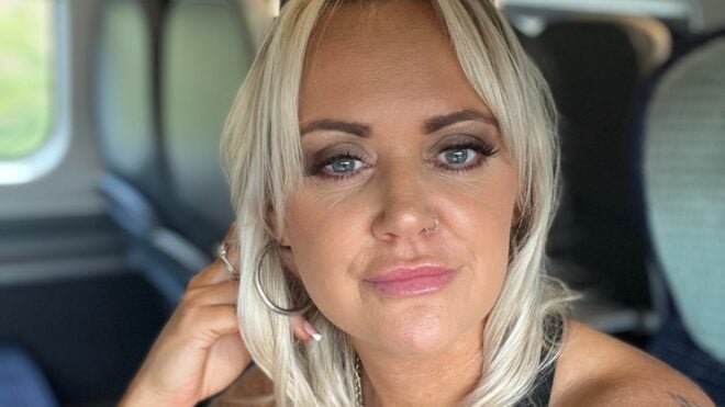 woman with brain tumors from birth control