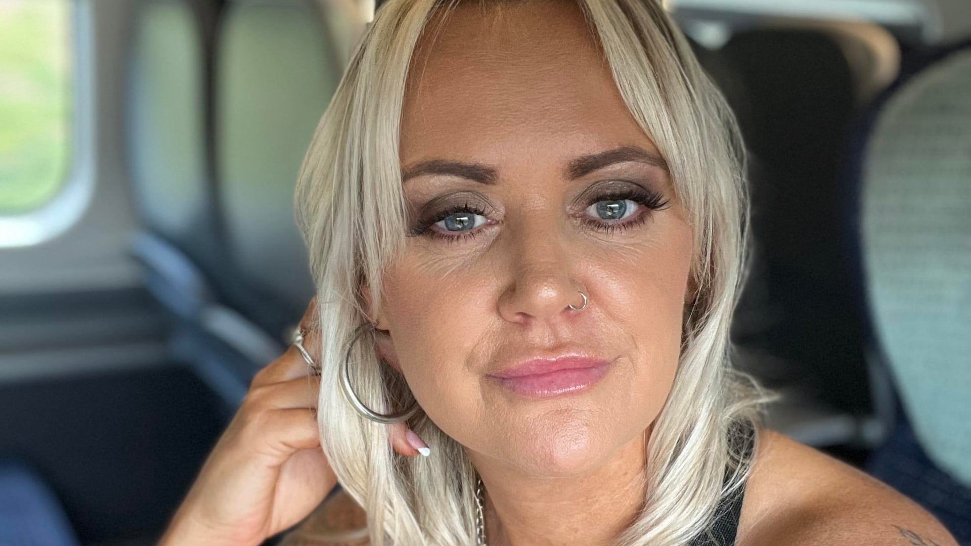 woman with brain tumors from birth control