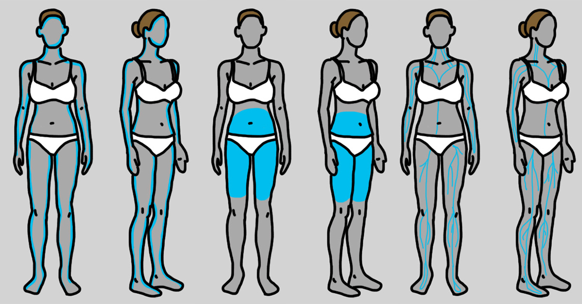 thyroid problems
