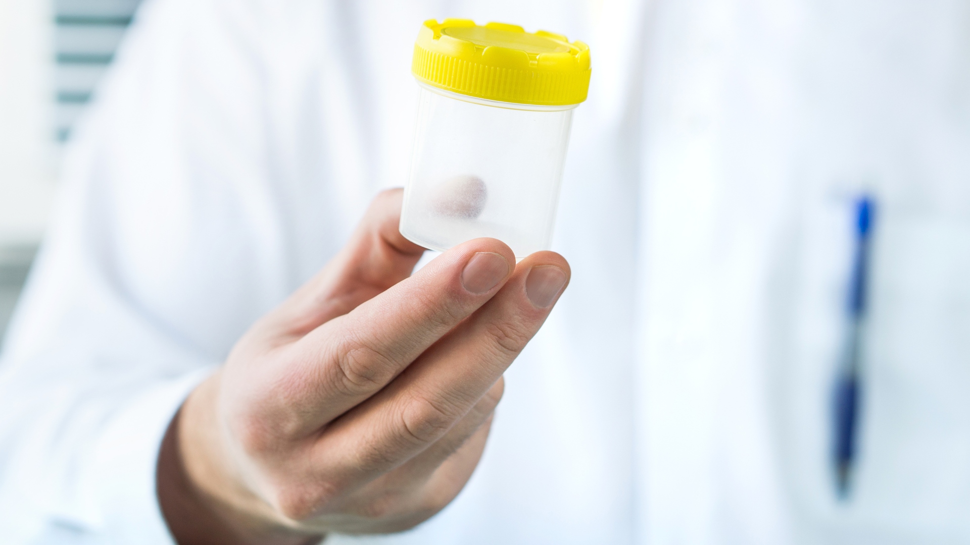 Doctor holding urine sample cup. Medical test in hospital.